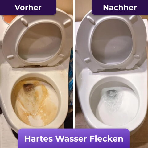 FizzClean Erfahrungen image